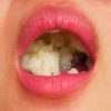 Thumbnail of related posts 177